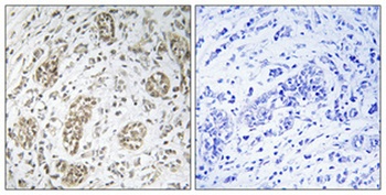 IKKγ rabbit pAb Antibody