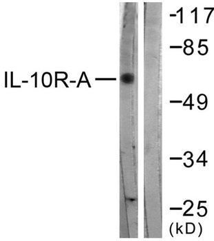 IL-10Rα rabbit pAb Antibody
