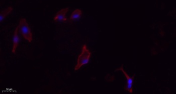 IL2 Rabbit Polyclonal Antibody