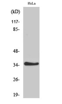 IL-20Rβ rabbit pAb Antibody