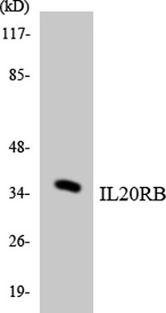 IL-20Rβ rabbit pAb Antibody