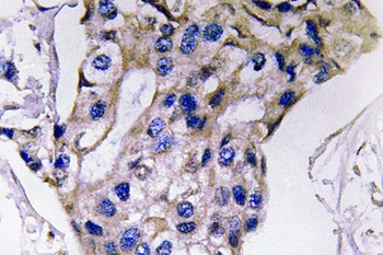 IL-5 rabbit pAb Antibody