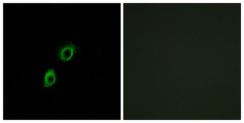 INSL4 rabbit pAb Antibody