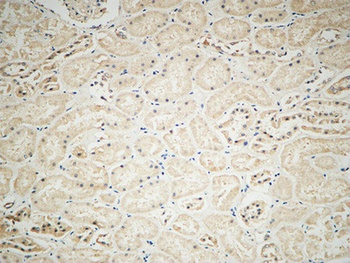 Integrin αV rabbit pAb Antibody