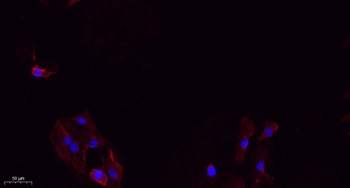 Integrin β3 rabbit pAb Antibody
