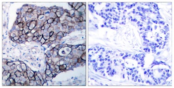 Integrin β3 rabbit pAb Antibody