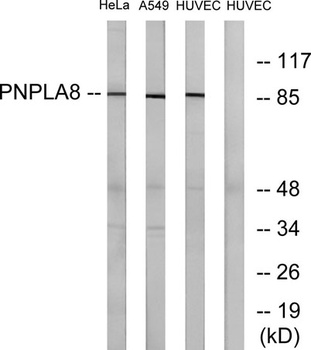 iPLA2γ rabbit pAb Antibody