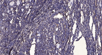 iPLA2γ rabbit pAb Antibody