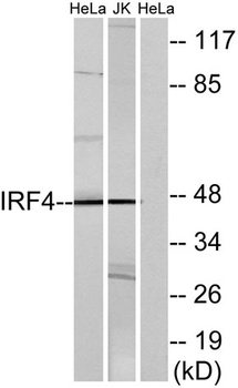 IRF-4 rabbit pAb Antibody