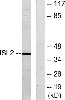 Islet-2 rabbit pAb Antibody