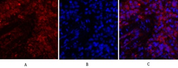 JAK1 rabbit pAb Antibody