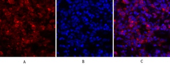 JAK1 rabbit pAb Antibody