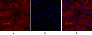 JAK1 rabbit pAb Antibody
