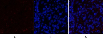 JAK2 rabbit pAb Antibody