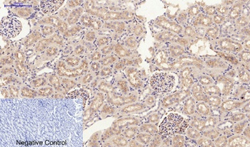 JAK2 rabbit pAb Antibody