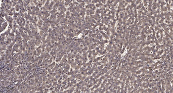 KIF4A rabbit pAb Antibody