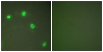 Ku-70 rabbit pAb Antibody