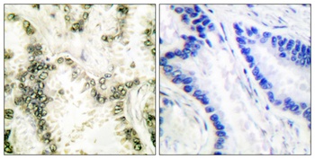 Ku-70 rabbit pAb Antibody