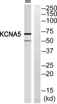 KV1.5 rabbit pAb Antibody