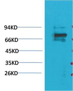 KV1.5 rabbit pAb Antibody
