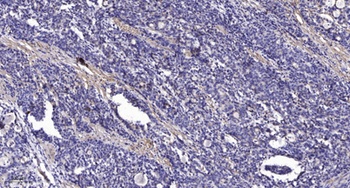 KV1.5 rabbit pAb Antibody