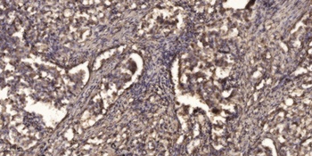 LAT rabbit pAb Antibody