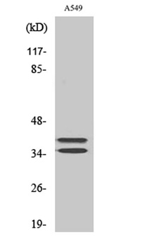 LAT rabbit pAb Antibody