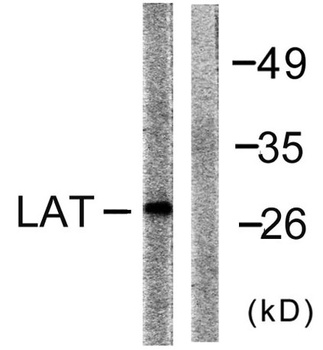 LAT rabbit pAb Antibody
