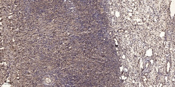 LAT rabbit pAb Antibody