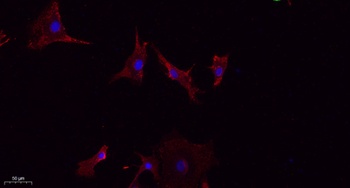 LATS1/2 rabbit pAb Antibody