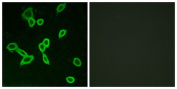 LGR6 rabbit pAb Antibody