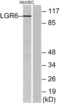 LGR6 rabbit pAb Antibody
