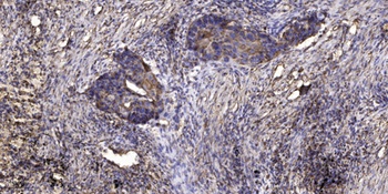 LGR6 rabbit pAb Antibody