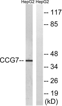 L-type Ca++ CP γ7 rabbit pAb Antibody