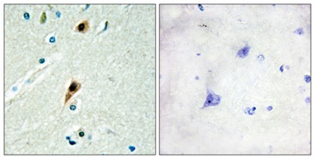 LUCA15 rabbit pAb Antibody