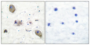 Lyn rabbit pAb Antibody