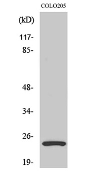 LYPLA1 rabbit pAb Antibody