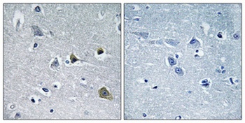 LYPLA1 rabbit pAb Antibody