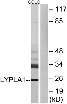 LYPLA1 rabbit pAb Antibody