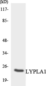 LYPLA1 rabbit pAb Antibody