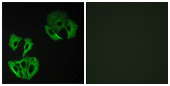 MADD rabbit pAb Antibody