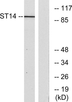 Matriptase rabbit pAb Antibody