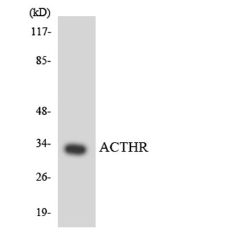 MC2-R rabbit pAb Antibody