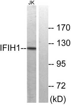 MDA5 rabbit pAb Antibody