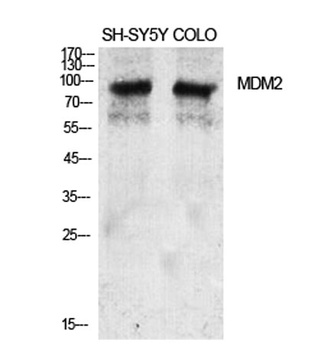 MDM2 rabbit pAb Antibody
