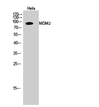 MDM2 rabbit pAb Antibody