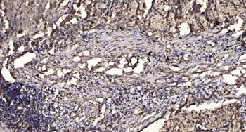 MEK-3 rabbit pAb Antibody