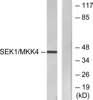 MEK-4 rabbit pAb Antibody