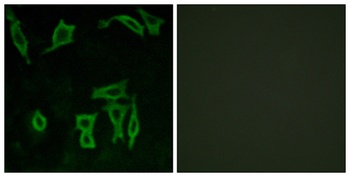 mGluR5 rabbit pAb Antibody