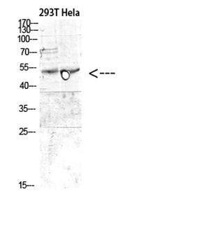 MITF rabbit pAb Antibody